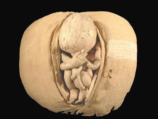 A Fabric Womb Made by Angélique du Coudray